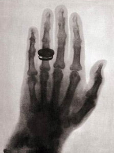 first x-ray